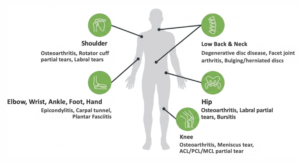 Common Conditions Treated by QC Kinetix Regenerative Medicine