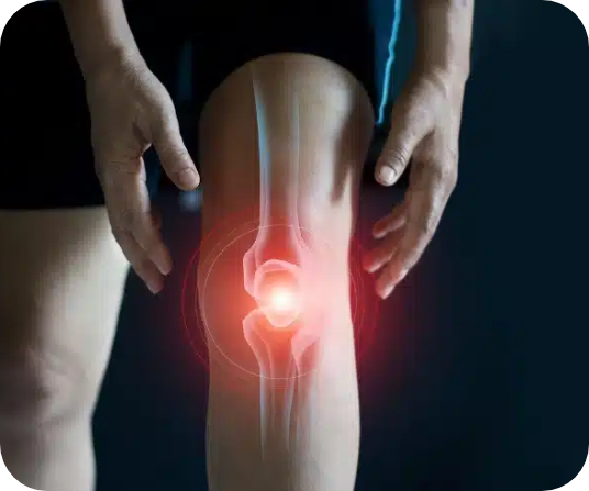 Cómo evitar la artroplastia de rodilla
