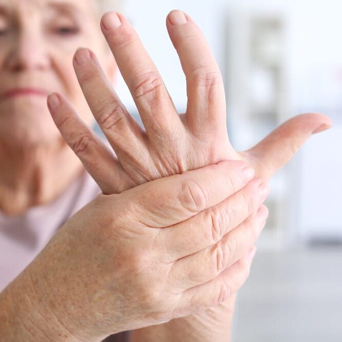 Fisioterapia para la artrosis: ¿Cuáles son mis opciones?